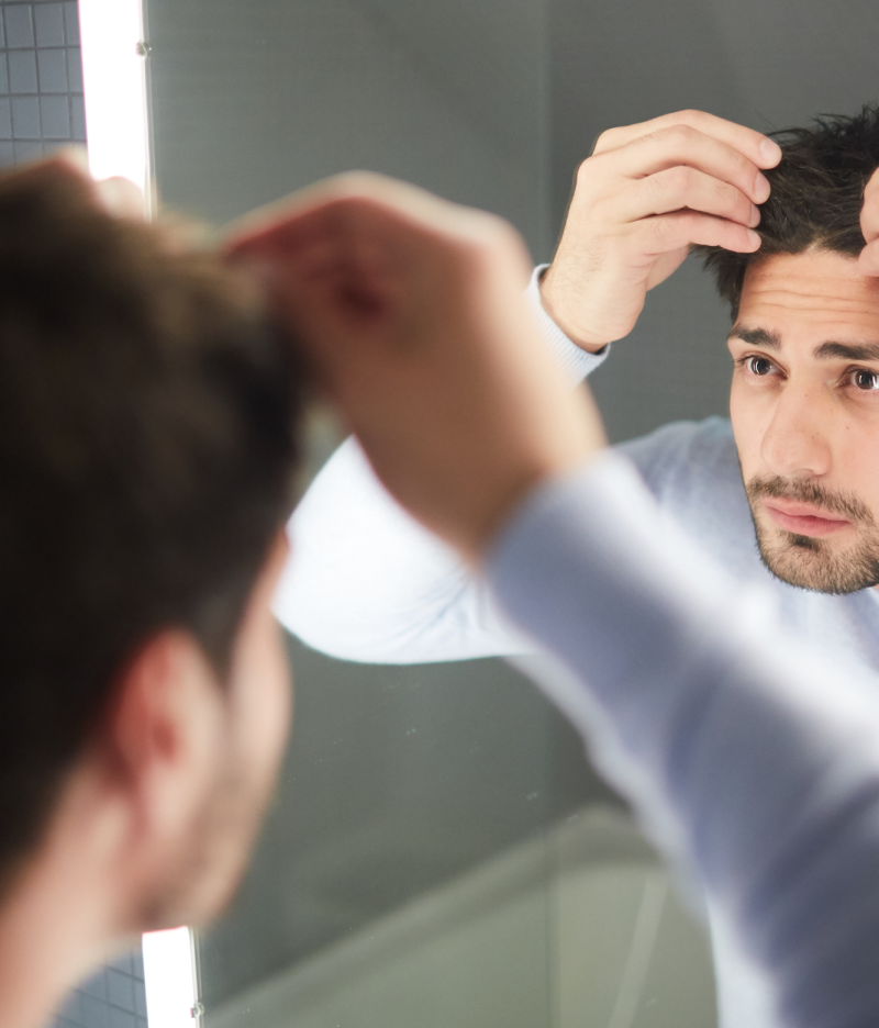 HAir loss